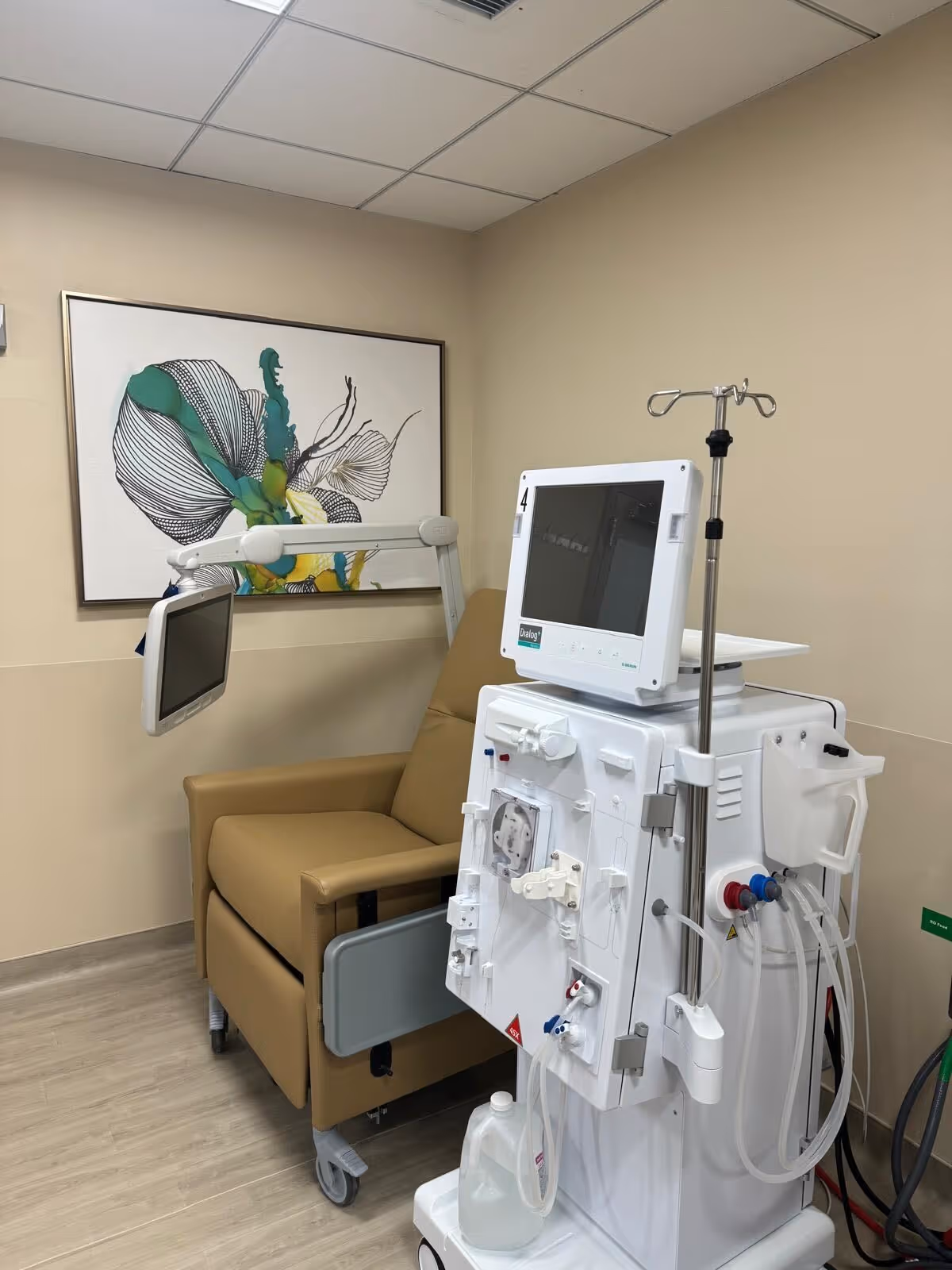 A medical treatment room featuring a beige recliner chair next to a dialysis machine with attached monitors and tubing. The room has light-colored walls and flooring, with a framed abstract artwork hanging on the wall behind the chair.